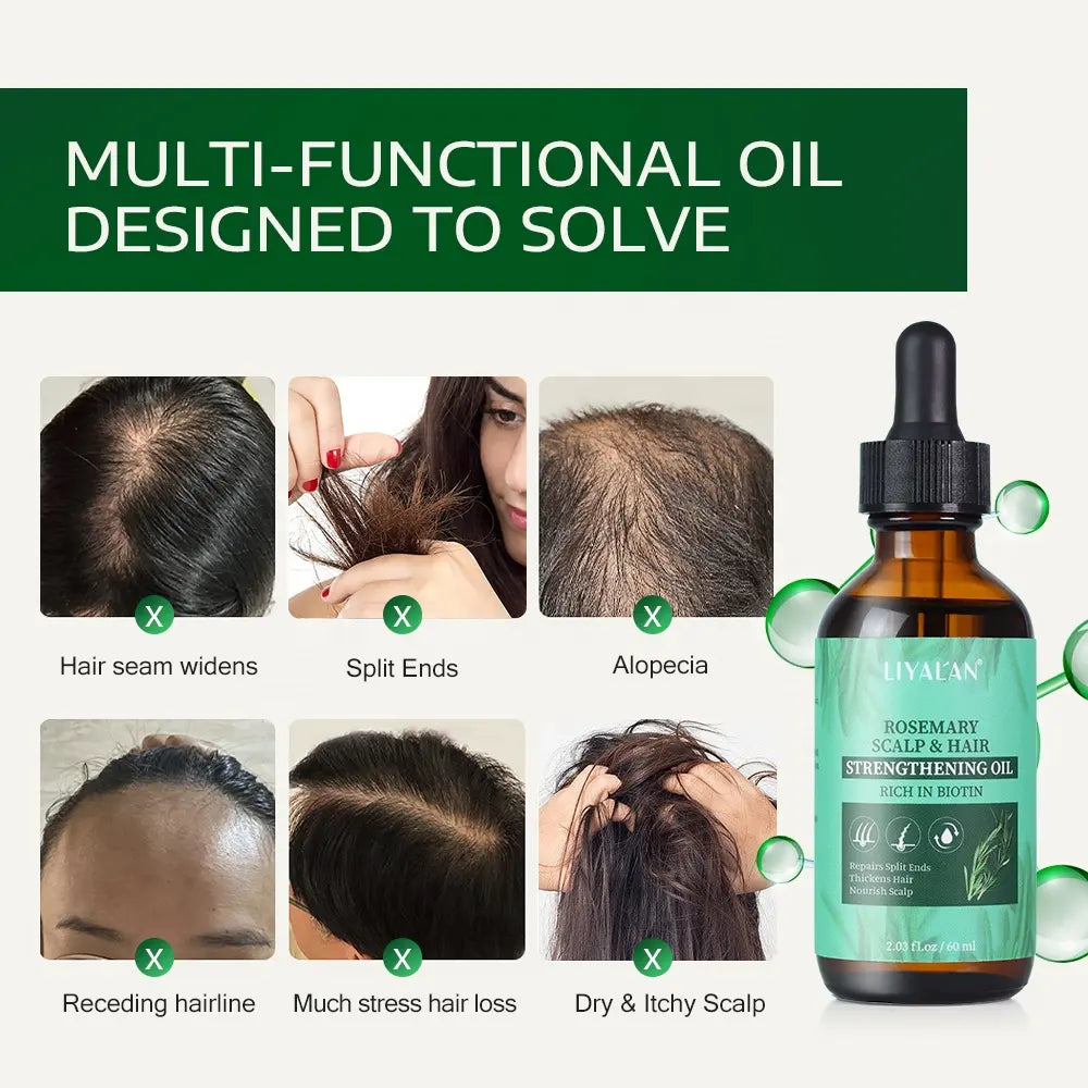 ROSEMARY SCULP & HAIR OIL